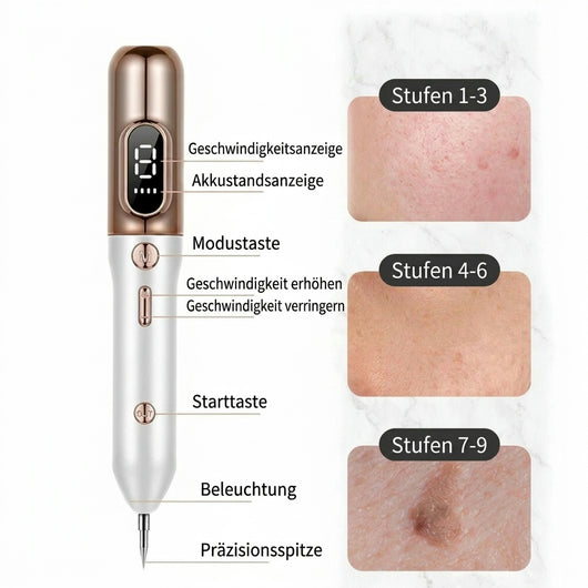 Plasmastift zur Entfernung von Muttermalen – 9 Intensitätsstufen für blutfreie Behandlung zuhause